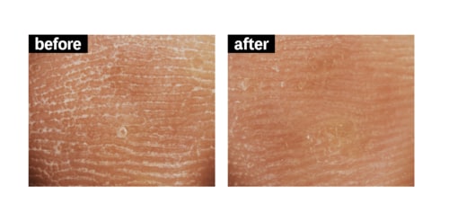 角質ケア ボディスクラブおすすめ イメージ