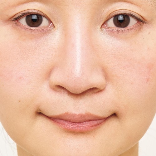 After プロ直伝の美肌テクおすすめ イメージ