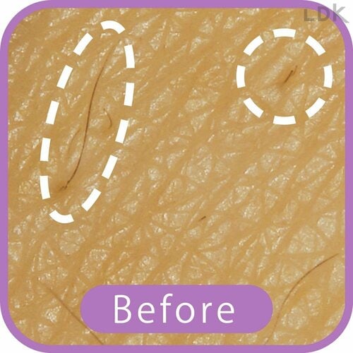 Before VIOシェーバーおすすめ イメージ
