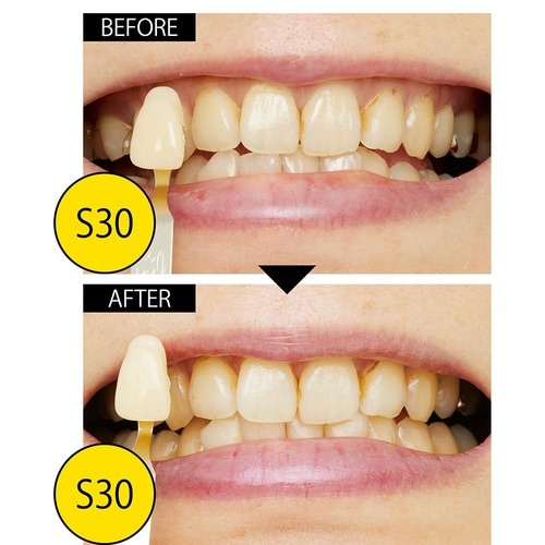 判定:ナシ やってる感はあるのに残念「Dr.USB/スパークリングイレーサー」 イメージ4