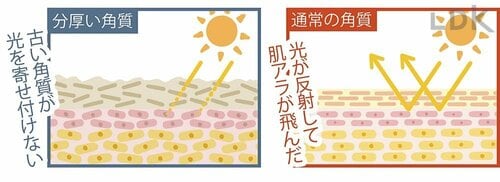 角質が厚いと受けた光を反射できず肌が暗く見える イメージ