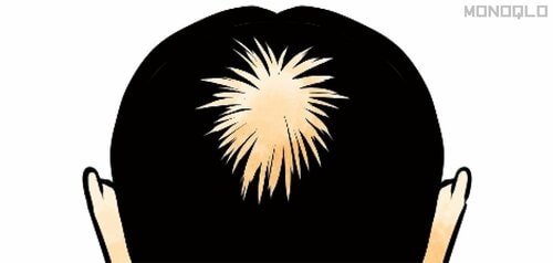 頭頂部(つむじ)が気になる場合 増毛パウダーおすすめ イメージ