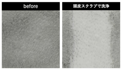 テスト1：洗浄力 頭皮スクラブおすすめ イメージ