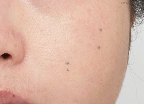 頬+小鼻に部分塗り LDK the Beautyインスタライブおすすめ イメージ