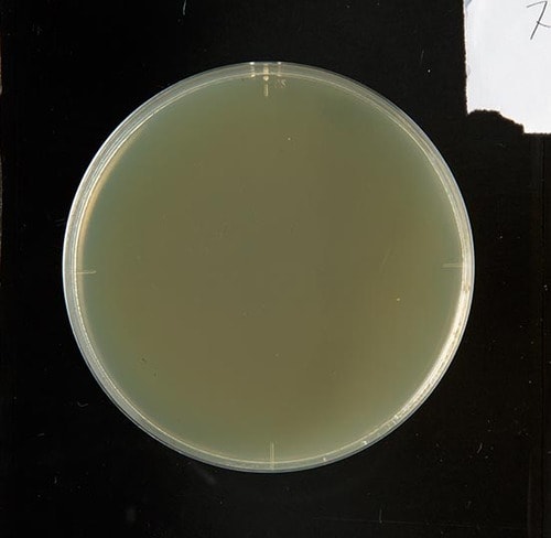 【テスト方法】食中毒菌とスポンジ 洗剤を垂らして除菌力をチェック イメージ4