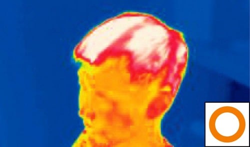 【遮熱性の高さ】耳がだいぶ赤くなっている サウナハットおすすめ イメージ