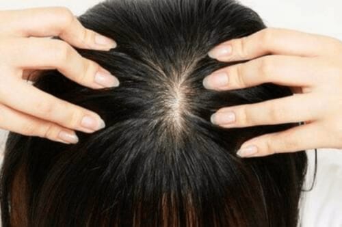 選び方2：敏感肌の人はやさしくケアできるものを選ぶ 育毛剤おすすめ イメージ