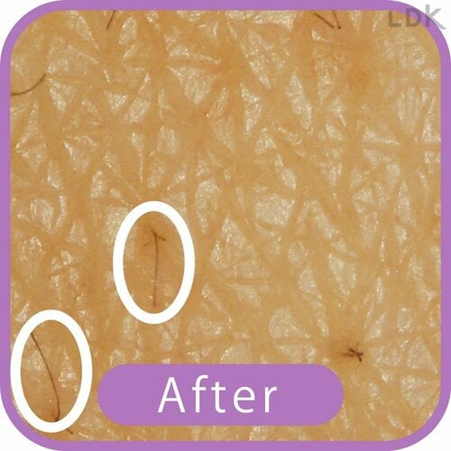 After VIOシェーバーおすすめ イメージ