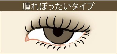 ▼腫れぼったいタイプ