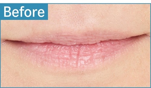 青み肌／薄め唇 色つきリップクリームおすすめ イメージ