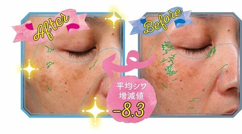 プチプラでマルチな効果に期待 無印良品「薬用リンクルケア美容液」