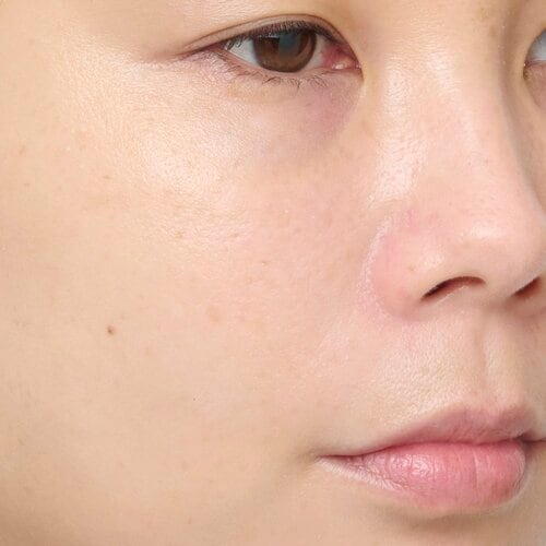 Before 黄ぐすみを補整する化粧下地おすすめ イメージ