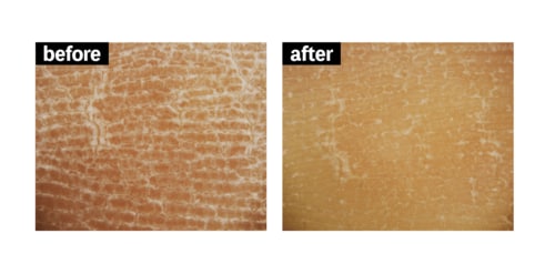 テスト1:角質ケア ボディスクラブおすすめ イメージ