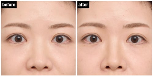 テスト1：仕上がり シェーディングおすすめ イメージ