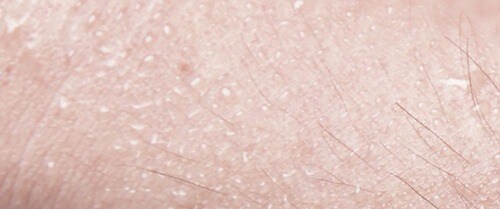 ロート製薬「デ・オウ 薬用プロテクト デオドラントロールオン」