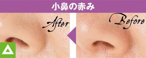 7位: 肌が乾燥して見えてボソボソの質感 コンシーラーおすすめ イメージ4
