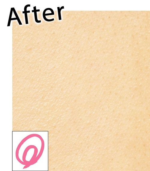 ▼After L字カミソリおすすめ イメージ