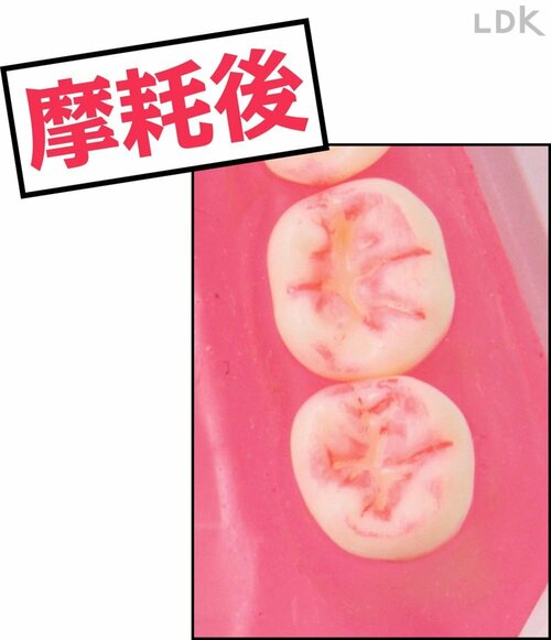 汚れ落ちの変化：摩耗後 歯ブラシおすすめ イメージ