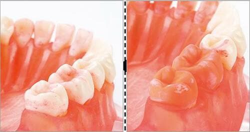 「ながら磨き」のオトモは 軽い・疲れない・高性能 イメージ4