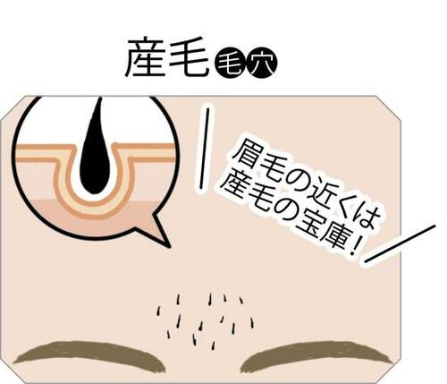 産毛毛穴:クリニックで脱毛がおすすめ! イメージ