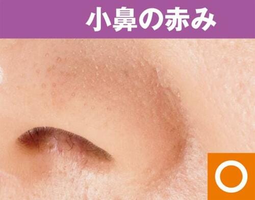 カバー力は抜群だけど仕上がりの質感はイマイチ コンシーラーおすすめ イメージ3