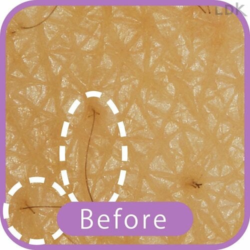 Before VIOシェーバーおすすめ イメージ