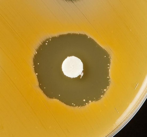 【テスト方法】食中毒菌とスポンジ 洗剤を垂らして除菌力をチェック イメージ