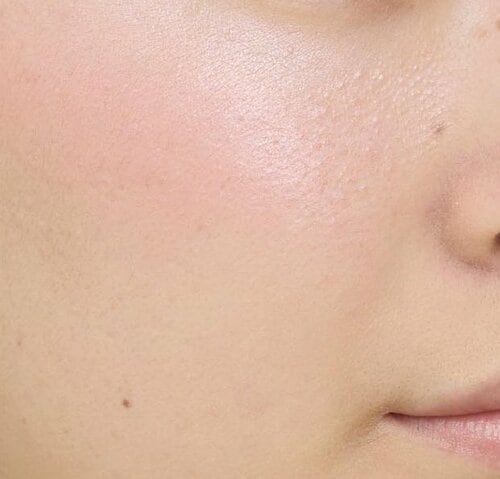 【ツヤ感】ギラギラ感のある青みピンクのツヤ チークおすすめ イメージ