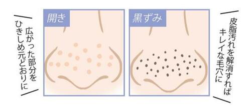 Q2. きちんとケアすれば毛穴の数は減るもの?