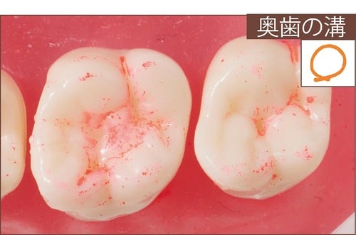 汚れ落ち：評価C イメージ5