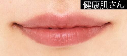 健康肌さん ソフトマットリップおすすめ イメージ