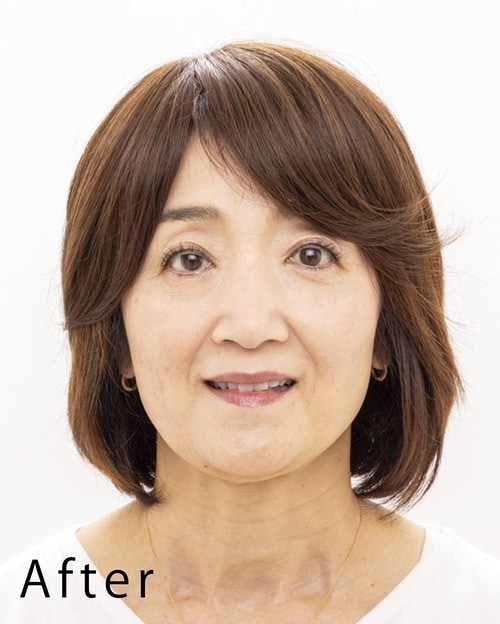 After ウィッグおすすめ イメージ