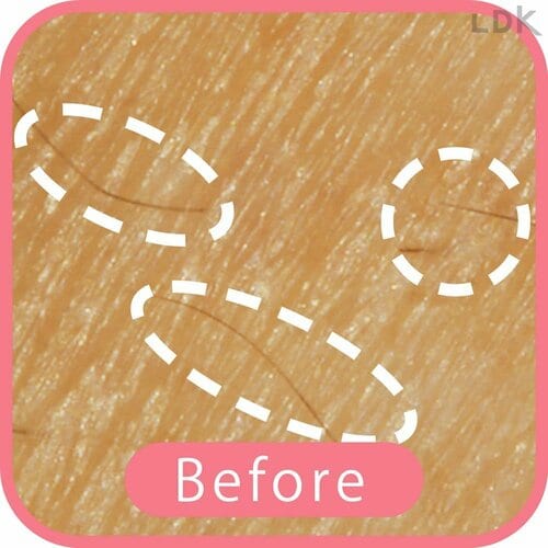 Before 女性用T字カミソリおすすめ イメージ