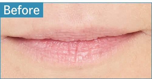 青み肌／薄め唇 色つきリップクリームおすすめ イメージ