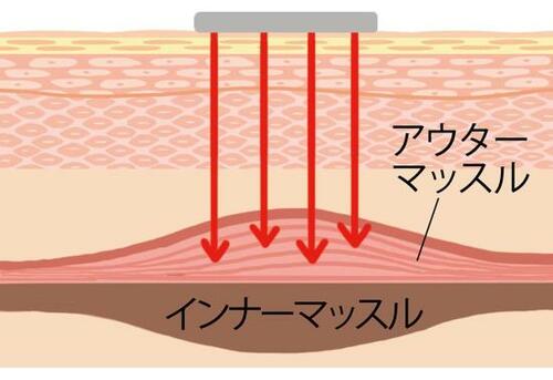 表情筋を鍛えるEMS(低周波) 美顔器おすすめ イメージ