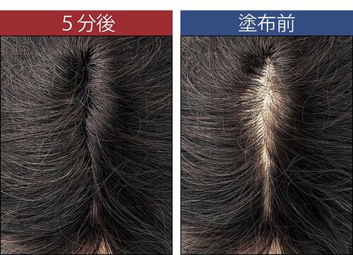 違和感なく増え見せ イメージ