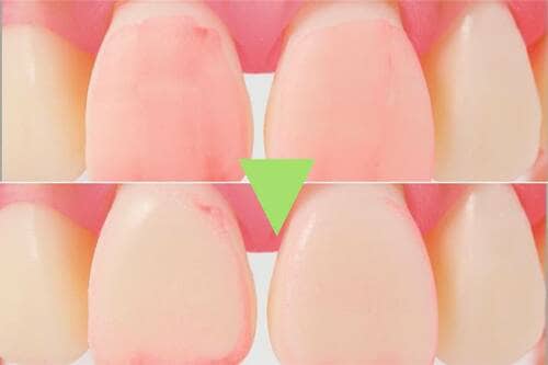 数回なでるだけで歯垢を落とした LDKベストバイ消耗品・雑貨おすすめ イメージ