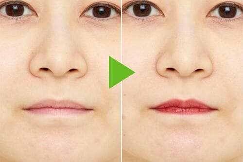 Before→After ローズリップおすすめ イメージ