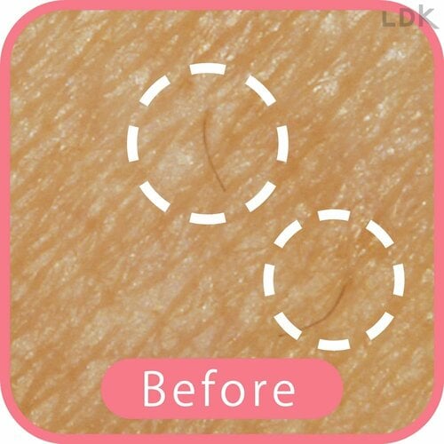 Before 女性用T字カミソリおすすめ イメージ