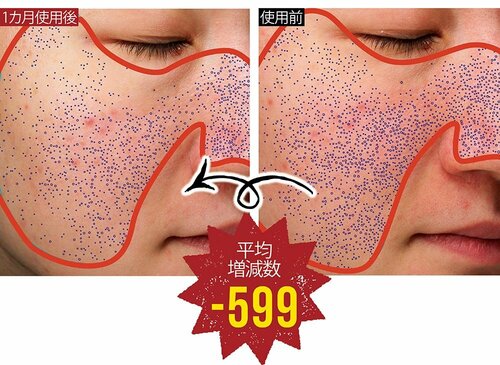 ベスコスの理由:モニター全員の毛穴に効果を発揮した