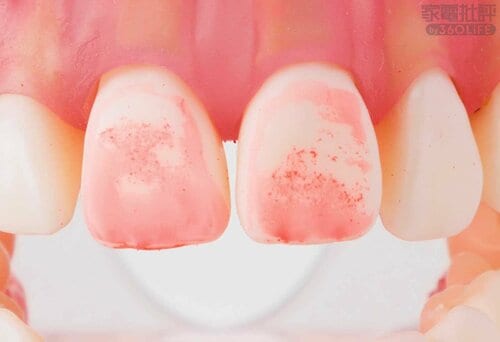 After 安い電動歯ブラシおすすめ イメージ