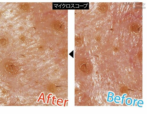 毛穴への効果 イメージ