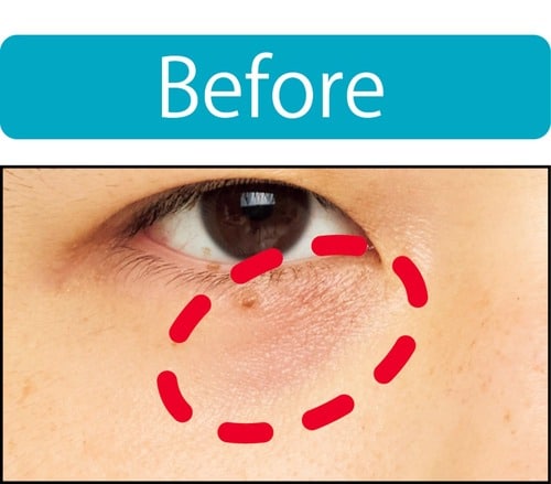 【クマ隠し】自然な感じで隠せた メンズコンシーラーおすすめ イメージ