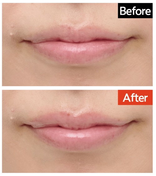 仕上がり：唇の輪郭がはっきりした リッププランパーおすすめ イメージ