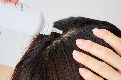 大人世代の髪悩みに応える育毛剤が知りたい 女性用育毛剤おすすめ イメージ