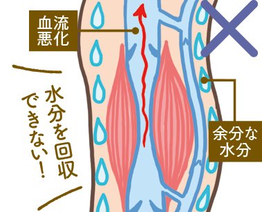 着圧をソックスをはくとどんな効果が期待できる？ 着圧ソックスおすすめ イメージ