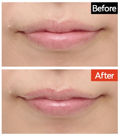 仕上がり：色ムラ補整効果あり リッププランパーおすすめ イメージ