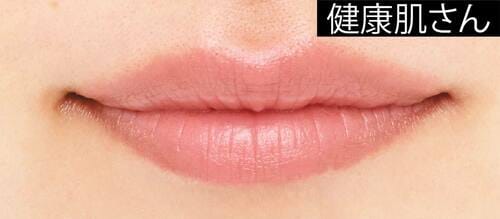 健康肌さん ソフトマットリップおすすめ イメージ