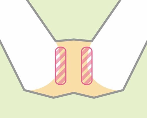 Iゾーン VIOシェーバーおすすめ イメージ