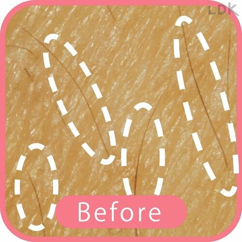 Before 女性用T字カミソリおすすめ イメージ